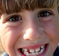 Interceptive Orthodontics: The Basics
