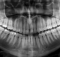 Dental X-Rays: It’s Time For Your Close-Up